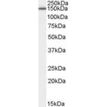 Western Blot - Anti-ROBO3 Antibody (A84343) - Antibodies.com