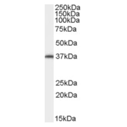 Western Blot - Anti-AIP Antibody (A84344) - Antibodies.com