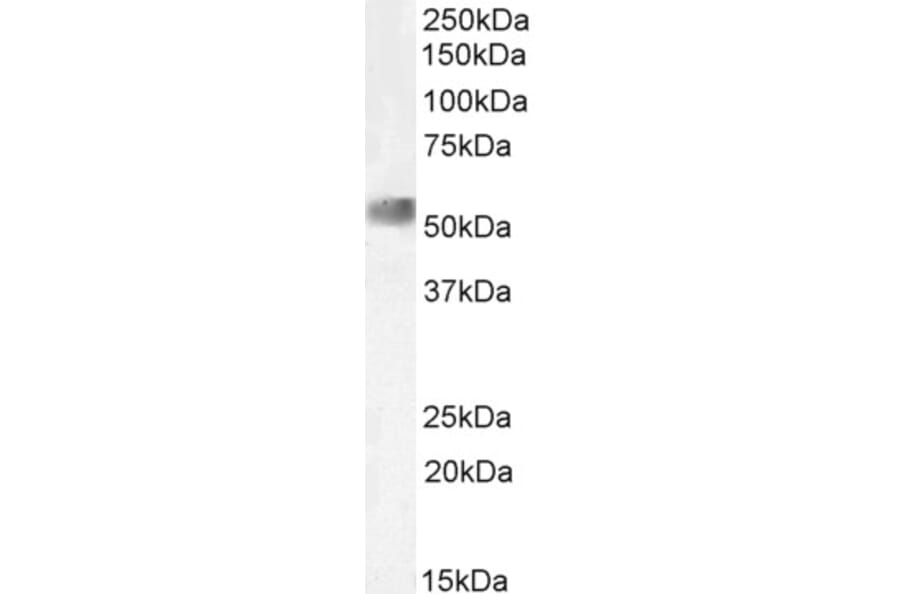 Western Blot - Anti-NR0B1/Dax1 Antibody (A84345) - Antibodies.com