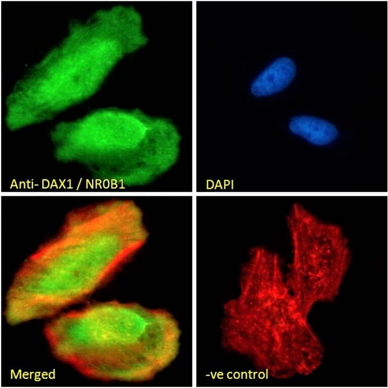 Immunofluorescence - Anti-NR0B1/Dax1 Antibody (A84345) - Antibodies.com