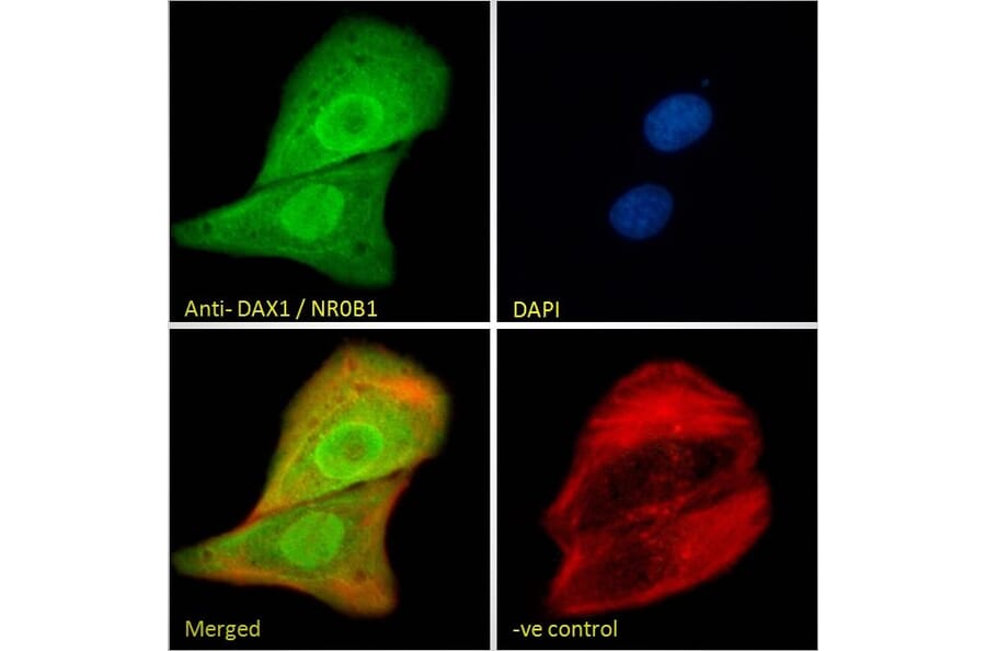Immunofluorescence - Anti-NR0B1/Dax1 Antibody (A84345) - Antibodies.com