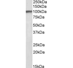 Western Blot - Anti-Huntingtin Associated Protein 1 Antibody (A84346) - Antibodies.com