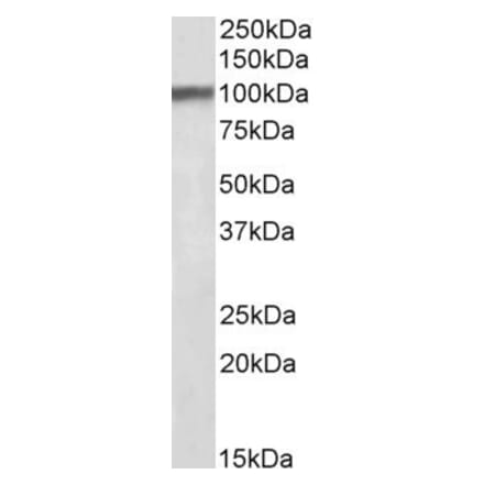 Western Blot - Anti-Huntingtin Associated Protein 1 Antibody (A84346) - Antibodies.com