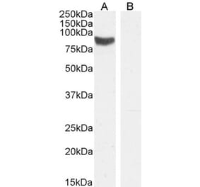 Western Blot - Anti-STRA6 Antibody (A84350) - Antibodies.com