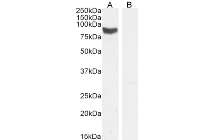 Western Blot - Anti-STRA6 Antibody (A84350) - Antibodies.com