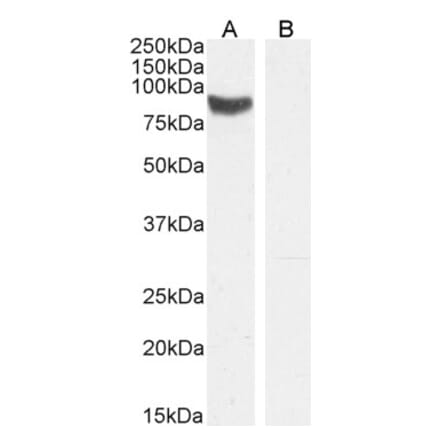Western Blot - Anti-STRA6 Antibody (A84350) - Antibodies.com