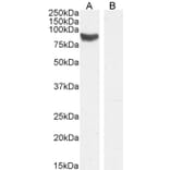 Western Blot - Anti-STRA6 Antibody (A84350) - Antibodies.com