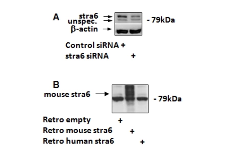 Western Blot - Anti-STRA6 Antibody (A84350) - Antibodies.com