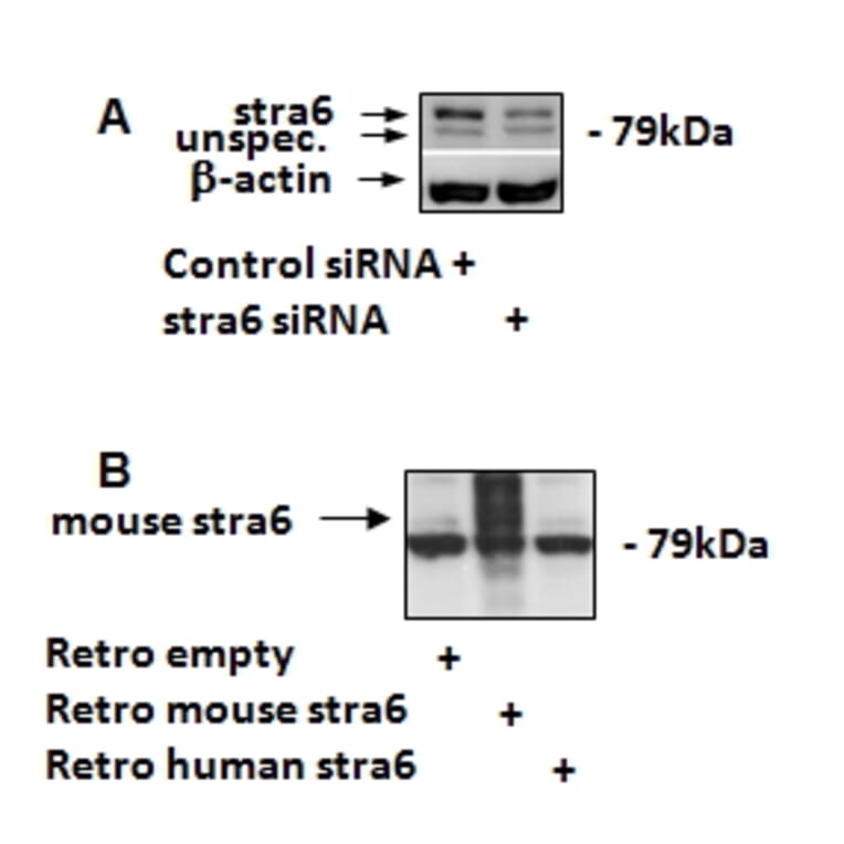 Western Blot - Anti-STRA6 Antibody (A84350) - Antibodies.com