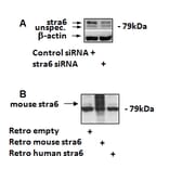 Western Blot - Anti-STRA6 Antibody (A84350) - Antibodies.com