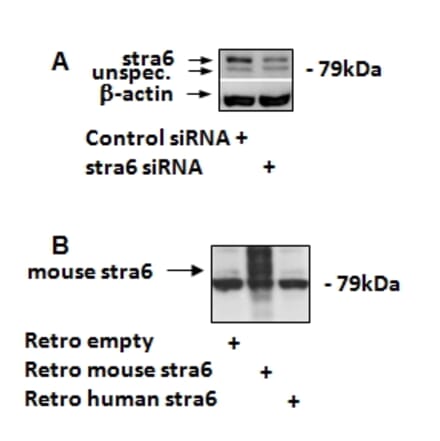 Western Blot - Anti-STRA6 Antibody (A84350)