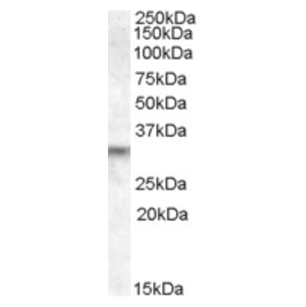 Western Blot - Anti-PRUNE2 Antibody (A84352) - Antibodies.com