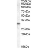 Western Blot - Anti-PRUNE2 Antibody (A84352) - Antibodies.com