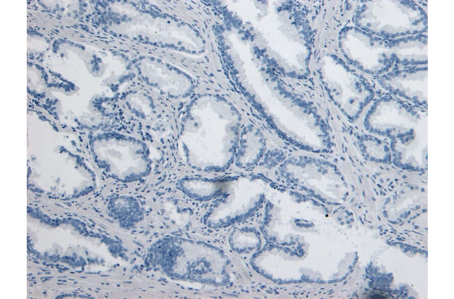 Immunohistochemistry - Anti-DPP4 Antibody (A84354) - Antibodies.com
