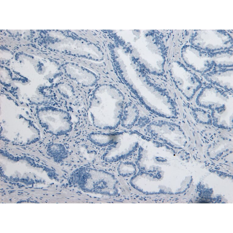 Immunohistochemistry - Anti-DPP4 Antibody (A84354) - Antibodies.com