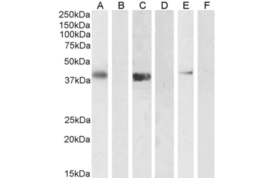 Western Blot - Anti-PTF1A Antibody (A84355) - Antibodies.com