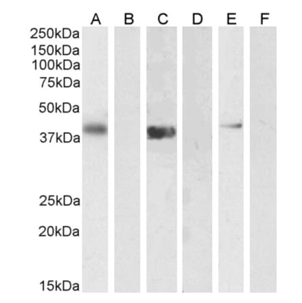 Western Blot - Anti-PTF1A Antibody (A84355) - Antibodies.com