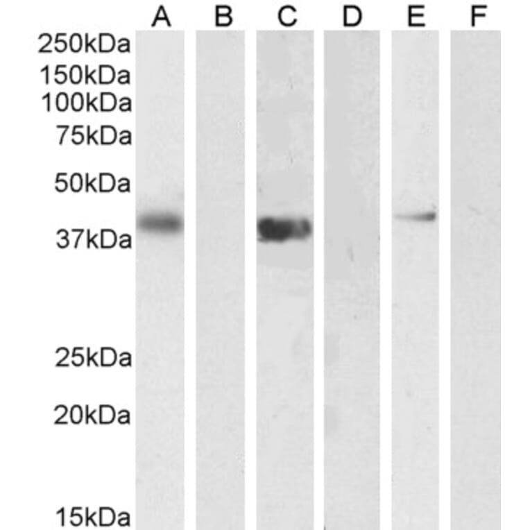 Western Blot - Anti-PTF1A Antibody (A84355) - Antibodies.com