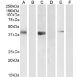 Western Blot - Anti-PTF1A Antibody (A84355) - Antibodies.com