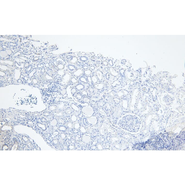 Immunohistochemistry - Anti-PGC1 alpha Antibody (A84356) - Antibodies.com