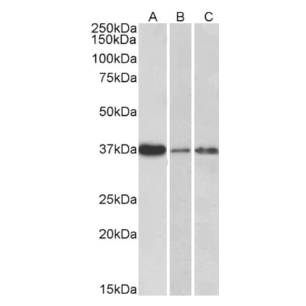 Western Blot - Anti-IL-12B Antibody (A84359) - Antibodies.com