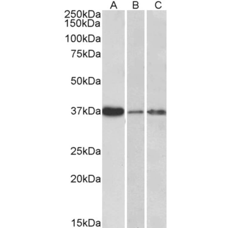 Western Blot - Anti-IL-12B Antibody (A84359) - Antibodies.com
