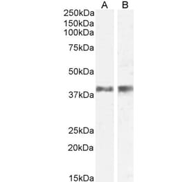 Western Blot - Anti-IL-12 p40 Antibody (A84360) - Antibodies.com