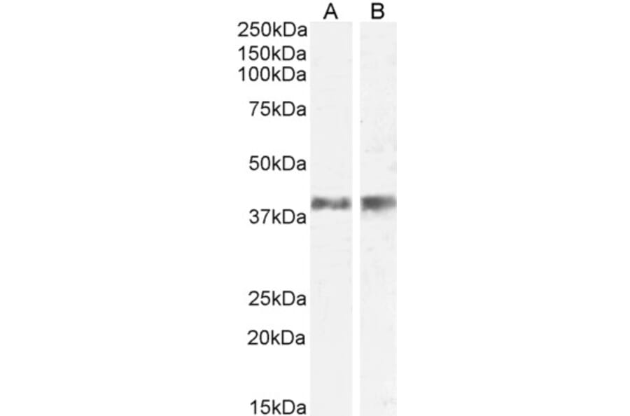 Western Blot - Anti-IL-12 p40 Antibody (A84360) - Antibodies.com