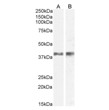 Western Blot - Anti-IL-12 p40 Antibody (A84360) - Antibodies.com