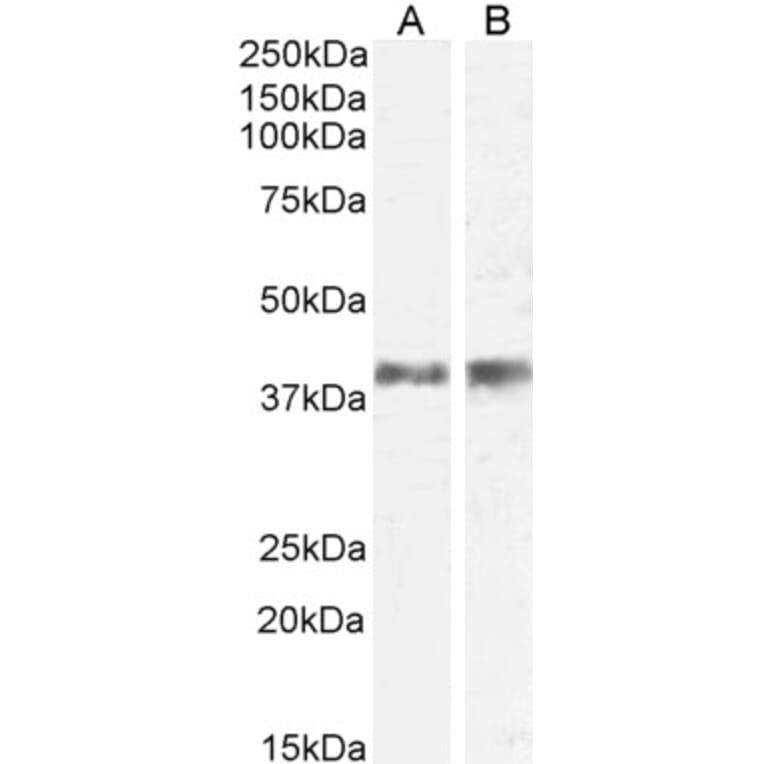 Western Blot - Anti-IL-12 p40 Antibody (A84360) - Antibodies.com