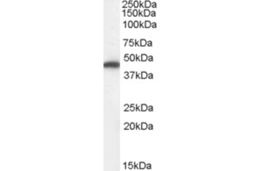 Western Blot - Anti-FH/Fumarase Antibody (A84362) - Antibodies.com