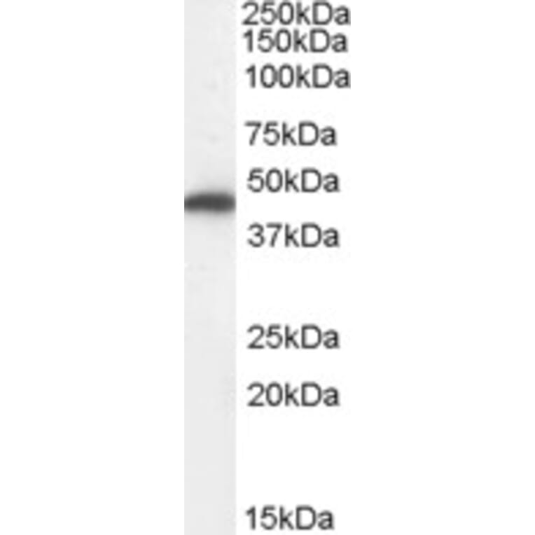 Western Blot - Anti-FH/Fumarase Antibody (A84362) - Antibodies.com