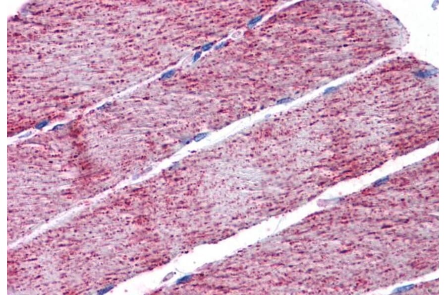 Immunohistochemistry - Anti-FH/Fumarase Antibody (A84362) - Antibodies.com