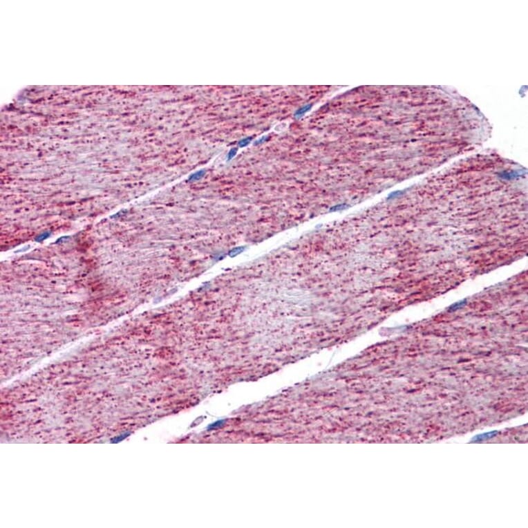 Immunohistochemistry - Anti-FH/Fumarase Antibody (A84362) - Antibodies.com