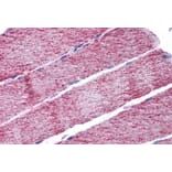 Immunohistochemistry - Anti-FH/Fumarase Antibody (A84362) - Antibodies.com