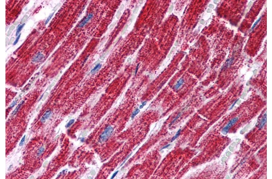Immunohistochemistry - Anti-FH/Fumarase Antibody (A84362) - Antibodies.com