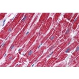 Immunohistochemistry - Anti-FH/Fumarase Antibody (A84362) - Antibodies.com