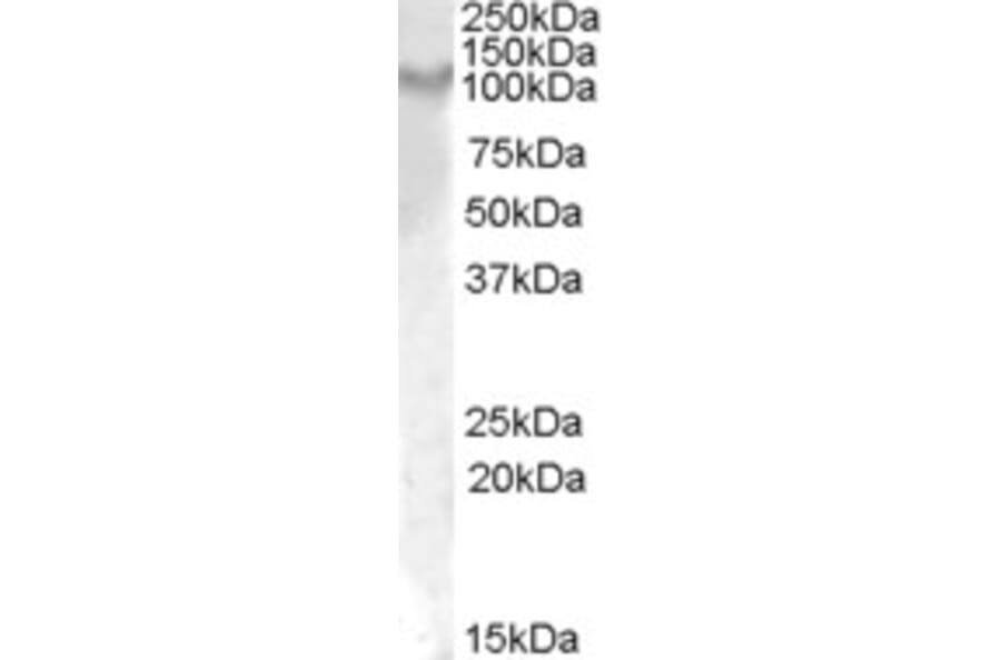 Western Blot - Anti-IL-17RA Antibody (A84364) - Antibodies.com