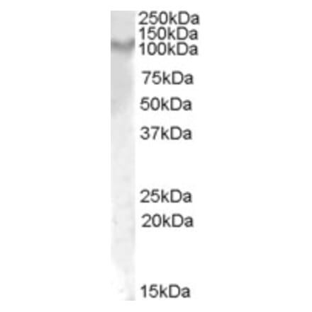 Western Blot - Anti-IL-17RA Antibody (A84364) - Antibodies.com