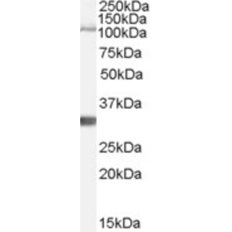 Western Blot - Anti-Insulin Degrading Enzyme/IDE Antibody (A84368) - Antibodies.com