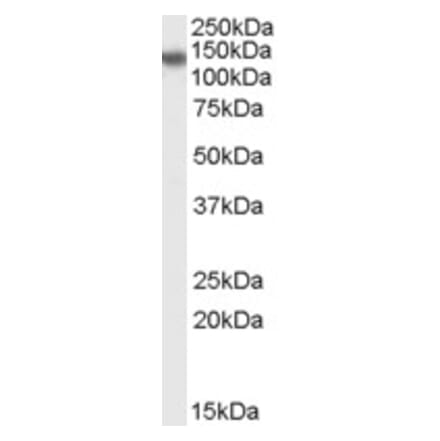 Western Blot - Anti-PHLPP2 Antibody (A84370) - Antibodies.com