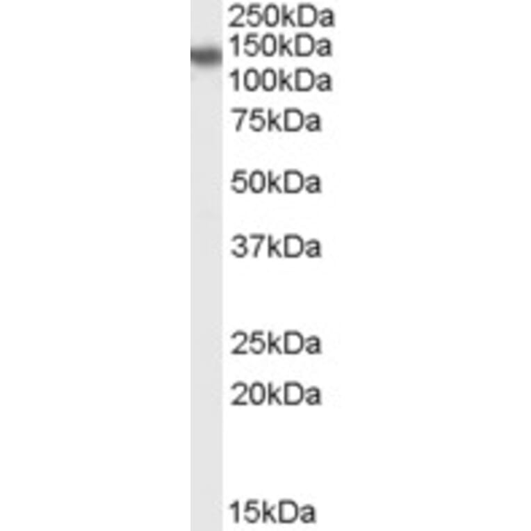 Western Blot - Anti-PHLPP2 Antibody (A84370) - Antibodies.com