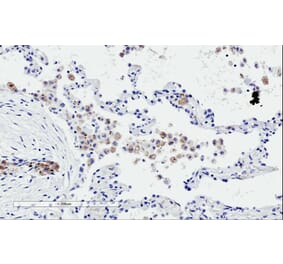 Immunohistochemistry - Anti-TREM2 Antibody (A84373) - Antibodies.com