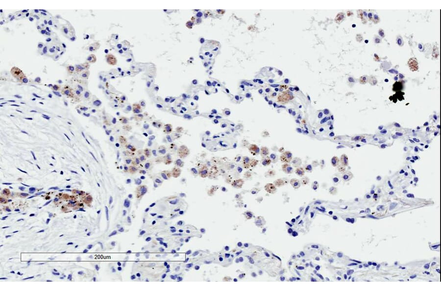 Immunohistochemistry - Anti-TREM2 Antibody (A84373) - Antibodies.com