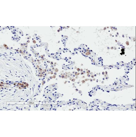 Immunohistochemistry - Anti-TREM2 Antibody (A84373) - Antibodies.com