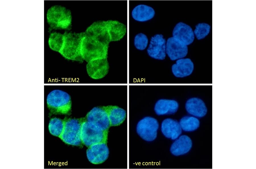 Immunofluorescence - Anti-TREM2 Antibody (A84373) - Antibodies.com