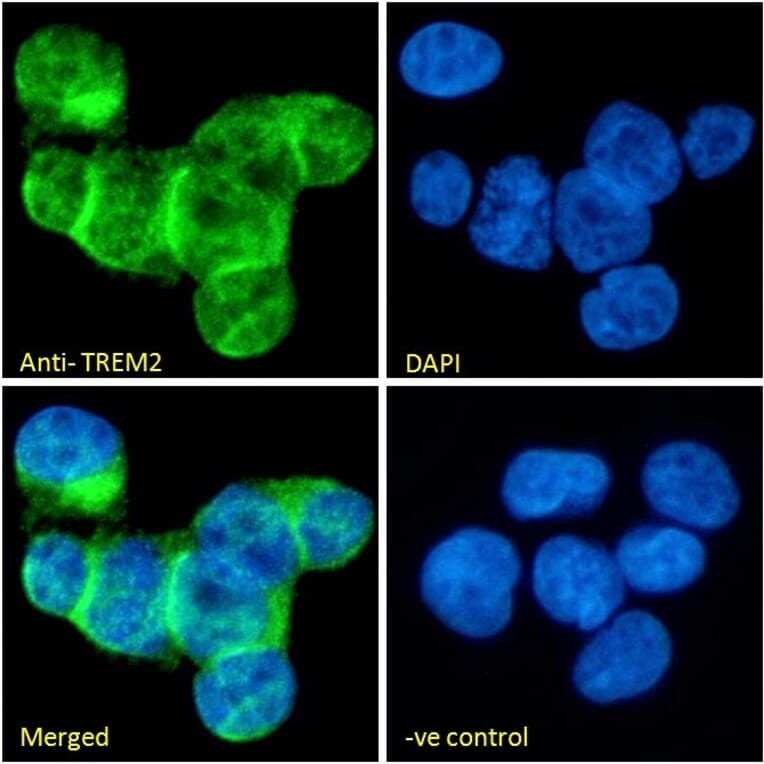 Immunofluorescence - Anti-TREM2 Antibody (A84373) - Antibodies.com