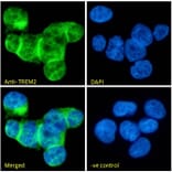 Immunofluorescence - Anti-TREM2 Antibody (A84373) - Antibodies.com