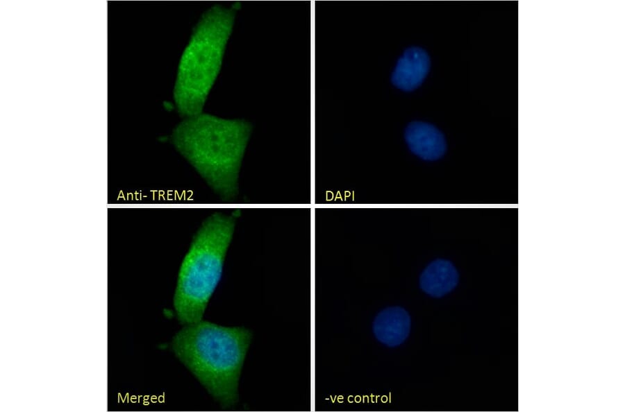 Immunofluorescence - Anti-TREM2 Antibody (A84373) - Antibodies.com