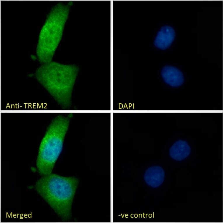 Immunofluorescence - Anti-TREM2 Antibody (A84373) - Antibodies.com